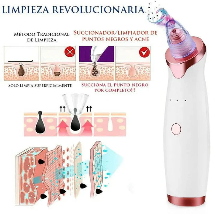 PorosFree Pro™ - “Elimina puntos negros y espinillas en segundos".